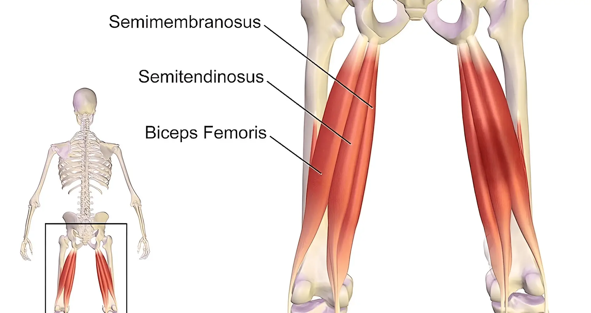 Is There An Ideal Hamstring Autograft Diameter for ACL Reconstruction?