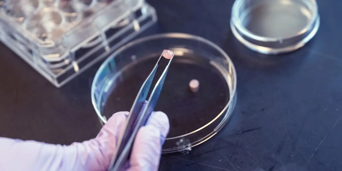 Engineered Cartilage Sounds Perfect