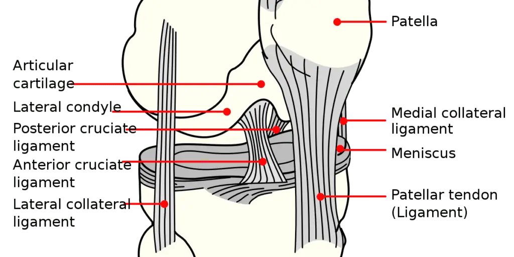Knee diagram - anterior cruciate ligament tear