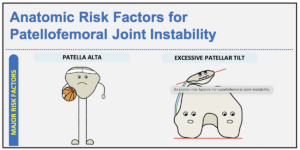 Anatomic Risk Factors for Patellofemoral Joint Instability: An Infographic as a Visual Learning Tool