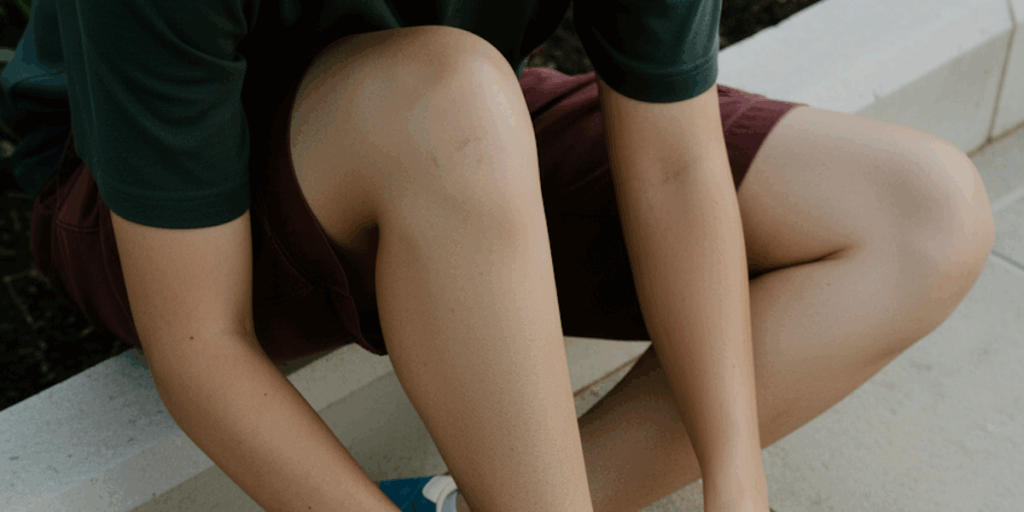 How Serious Is a Patella Dislocation?